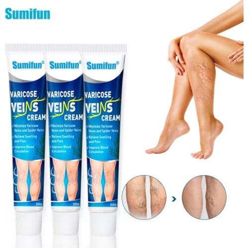 Sumifun 3Pcs Vasculitis Phlebitis Spider Legs Treatment Cream Varicose Veins Cream Varicosity Blood Vessel Swelling Plaster