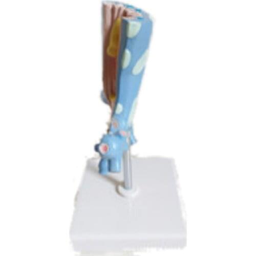 Human trachea bronchiopathic lesions anatomical teaching model medicine gift show respiratory model