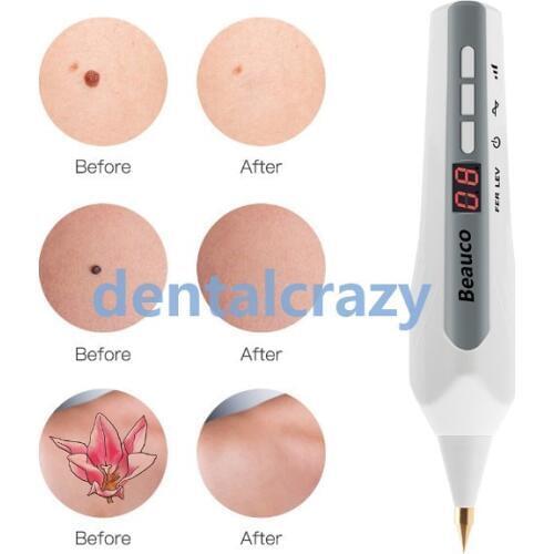 Face Beauty Equipment Laser spot Freckle Tattoo Skin Spots Remove Mole Wart Dark Spot Facial Beauty Plasma Pen