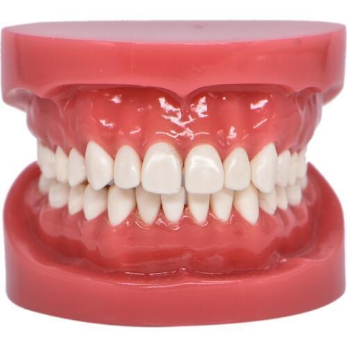 Dentition Model Upper Lower Jaw Model Red Dentist Hard Foundation Teaching Model Dental Adult Standard Typodont Demonstration