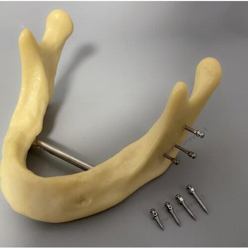 10Pis/Lot Orthodontic Screws Micro Implants Mini Screw Dental Self-Drilling Driver Spring Anchorage Implant Driver Screwdriver