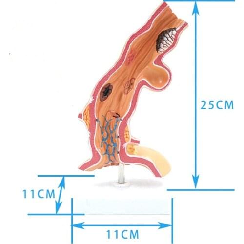 Esophagus Anatomical model Alimentary system Pathological anatomical model of esophagus medical teaching aids