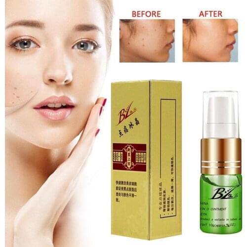 Tattoo Recovery Serum Mole Scar Skin Tag Removal Eyebrow Tattoo Repairing Essence Cream Anti-Scar Liquid Face Care
