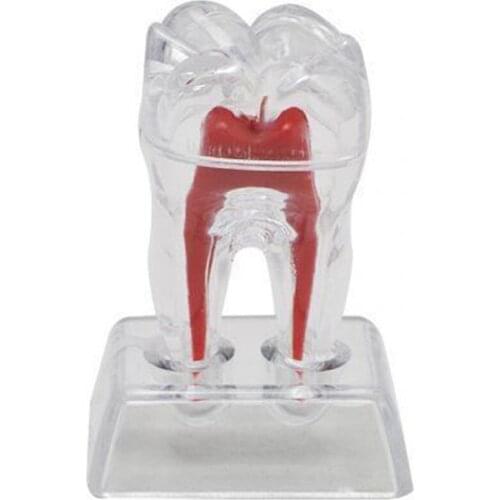 Large Tooth Molar Model Separable Teaching Demonstration Model Transparent Dentistry Material Lab Teeth Model