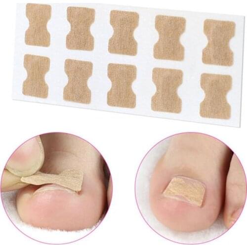 1/5pcs Ingrown Toenail Corrector Sticker Paronychia Fix Recover Corrector Bunion Pedicure Foot Toe Nail Care Tool Glue Free Safe