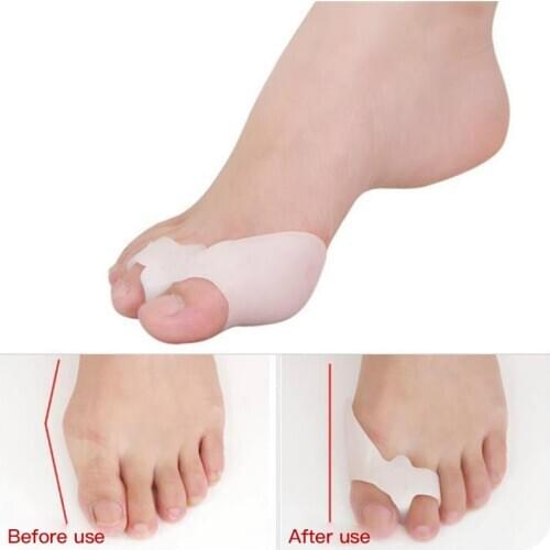2Pcs=1Pair Silicone Gel Foot Care Tool Bunion Corrector Bone Big Toe Protector Hallux Valgus Straightener Toe Spreader Pedicure