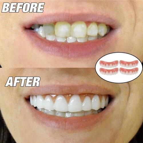 Teeth Veneers Denture Teeth Whitening Braces Toy Fake Tooth Cover Beauty Veneers Teeth Upper Cosmetic Teeth