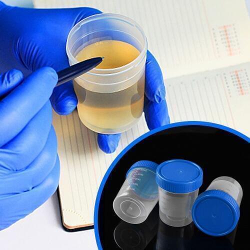 10 Leak Proof Liquid Container Clear Plastic Storage Pot Graduated Urine Specimen Collection Cup Organizer Jar for Drug Testing