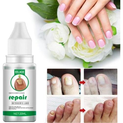 10ml/ 20ml/ 30ml Nail Repair Essences Renew Thick Nails Effective Nails Care Nail Restoring Repair Essences for Toe