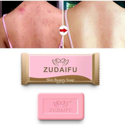 Sulfur Soap Skin Cleaning Acne Seborrhea Anti Fungus Soap Bath Whitening Healthy Soap Anti-mite Soap 7g TSLM1
