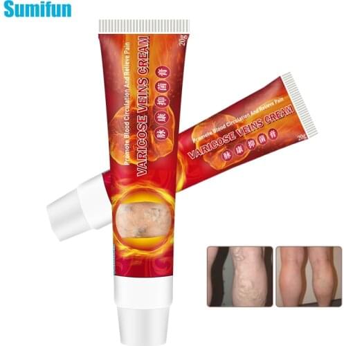 Sumifun 1 pcs Effective Original Varicose Veins Treatment Cream Vasculitis Phlebitis Spider Pain Relief Ointment P1109