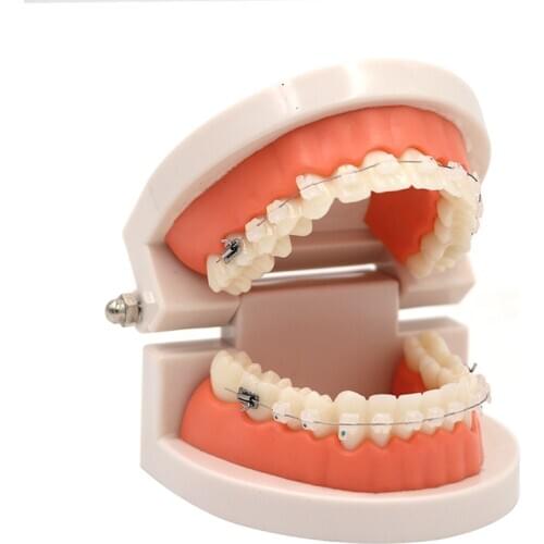 Dental Orthodontic Model Full Ceramic Bracket With Anti-nail For Dentist Medical Disease Teaching Study Oral Care
