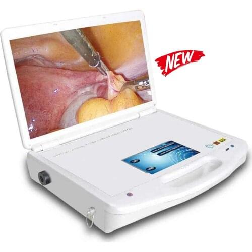 Portable endoscope camera medical endoscope camera for Laparoscopy Thoracoscopy Cystoscopy minimally invasive surgery