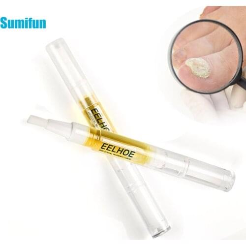 1Pcs Fungal Onychomycosis Oil Nail Treatment Ointment Antibacterial Toe Anti Infection Nail Repair Liquid Hand Foot Care