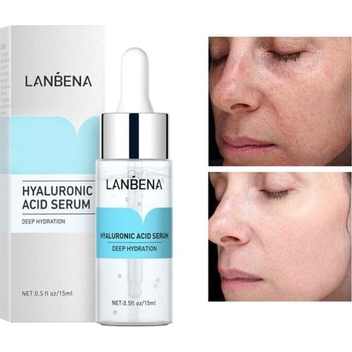 Vitamin C Whitening Face Serum Lighten Spots Brightening Facial Skin Essence Fade Dark Spots Remove Freckle Speckle Skin Care