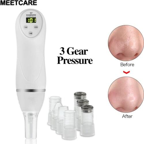 Mini Diamond Dermabrasion Skin Peeling Facial Blackhead Acne Pore Removal Microdermabrasion Vacuum Face Massage Beauty Skin Care