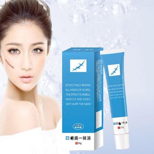 20g Scar Removal Cream Cream for FACIAL Acne Scars Repair Cream Spots Stretch Acne Acne Remover Skin Marks F0E9