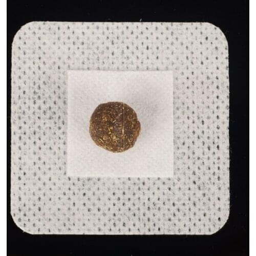 30 Wormwood Moxa Moxibustion Acupoint Sticking Moxibustion Belly Button Sticker Traditional Chinese Acupuncture Points Massager