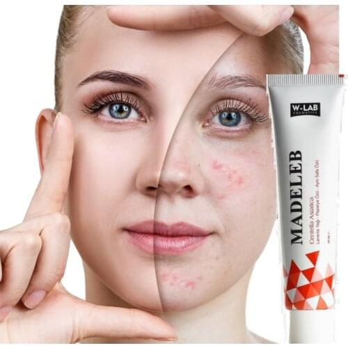 Madeleb W-Lab Skin Renewal Cream 40 Ml Skin Wounds Psoriasis Eczema Acne Problems Cell Regeneration