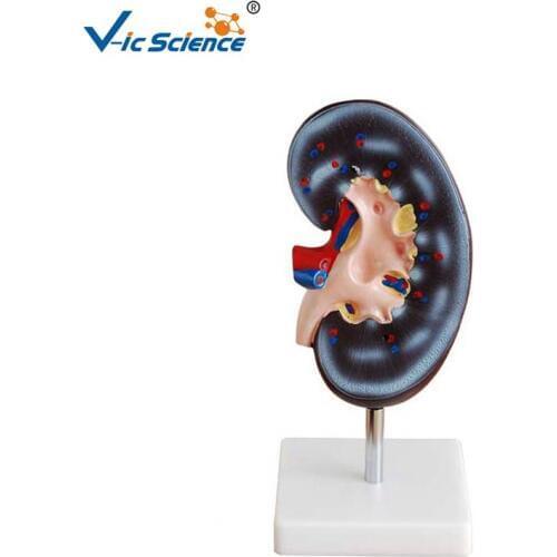 Human kidney Anatomy model for Medical Study