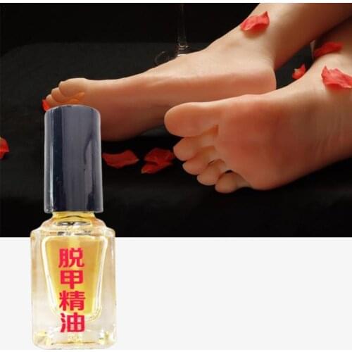 New3 Days Effect Fungus Removal Essence Liquid Fungal Nail Treatment Bright Nail Repair Anti Infection Foot Caring Onychomycosis