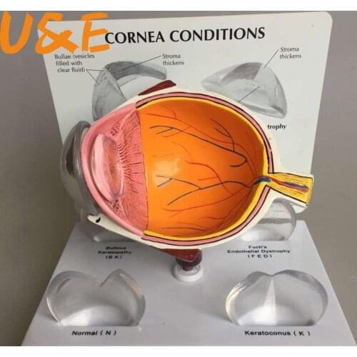 4X Human Pvc Eye Cataract Anatomy Medical Teaching Model