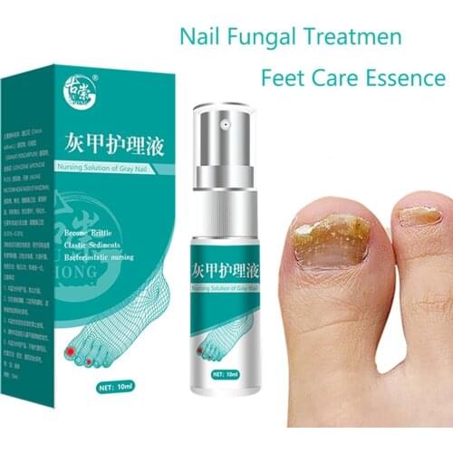 Nail Fungus Feet Care Essence Nail Foot Caring Toe Nail Fungus Removal Gel Anti Infection Paronychia Onychomycosis
