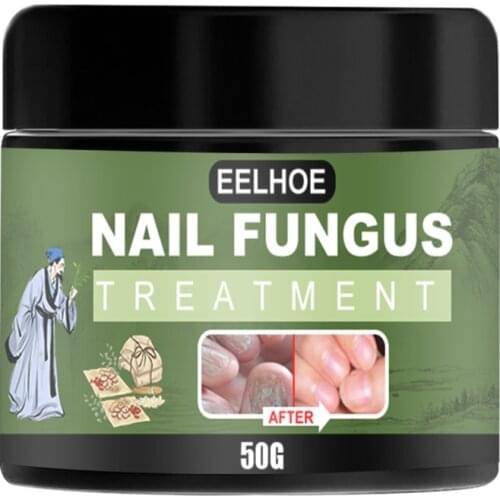 Nail Repair Cream Onychomycosis Paronychia Anti Fungal Nail Ointment Toe Nail Fungus Serum Feet Health Care 50g/30g/20g/10g