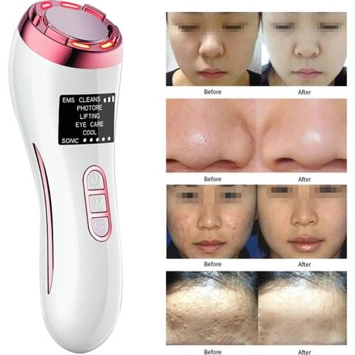 7in1 EMS LED Photon Therapy Sonic Vibration Wrinkle Remover Hot Cool Skin Cleaner Cleansing Rejuvenation Facial Massage Portable