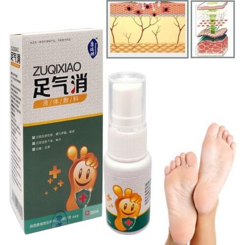 20ML Feet Spray Antibacterial Deodorant Powder Anti Itch Sweat Odor Feet Athletes Foot Liquid Anti-fungi Shoe Sock Feet Care