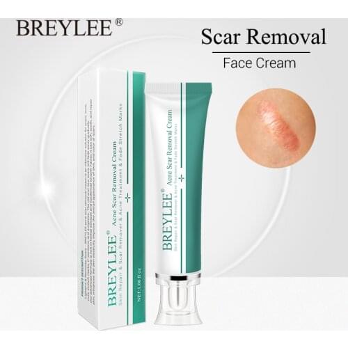 BREYLEE Acne Scar Removal Cream 30g Face Cream Skin Repair Skin Care Scar Acne Treatment Remove Stretch Marks Whitening Cream