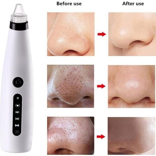 Pore Cleaner Blackhead Removal Facial Nose Vacuum Clean Pore Acne Removal Blackhead Machine USB Charging Skin Care Tool