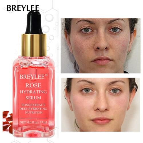 BREYLEE Rose Hydrating Serum Deep Nourishing Moisturizing Facial Essence Improve Dry Dull Skin Whitening Soothing Anti-Aging