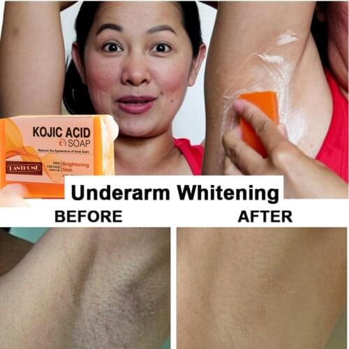 Dark Black Skin Lightening Soap Kojic Acid Whitening Soap Kojic Acid Glycerin Brighten Face Body Skin Bleaching Turmeric Soap