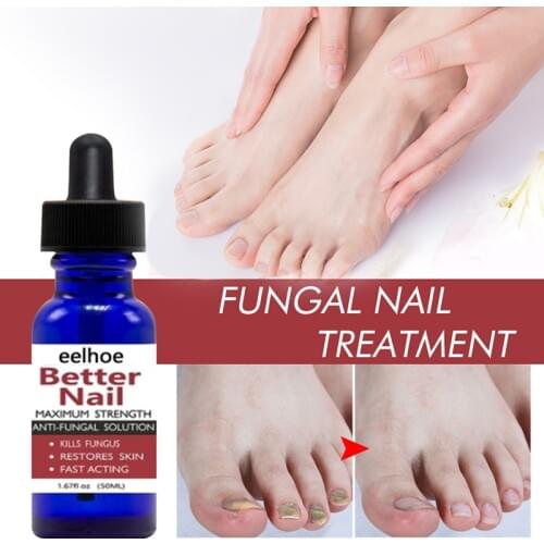 50ml Fungal Nail Repair Serum For Toe Nail Fungus Removal Anti-infective Paronychia TXTB1