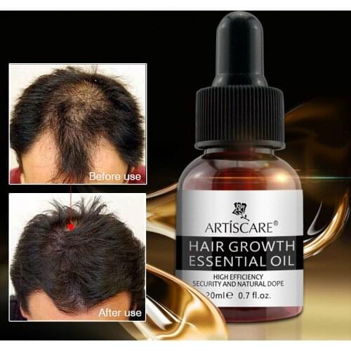 Hair Growth Essential Oil Hair Care Repair Treatment Dense for Women Men Hair Regrowth Serum