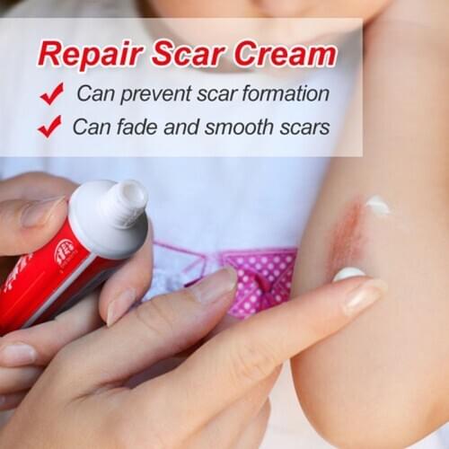 60g Scar Removal Skin Repair Cream Natural Pure Lavender Serum Acne Burn Stretch Marks Spots Remover Gel Whitening Skin Care