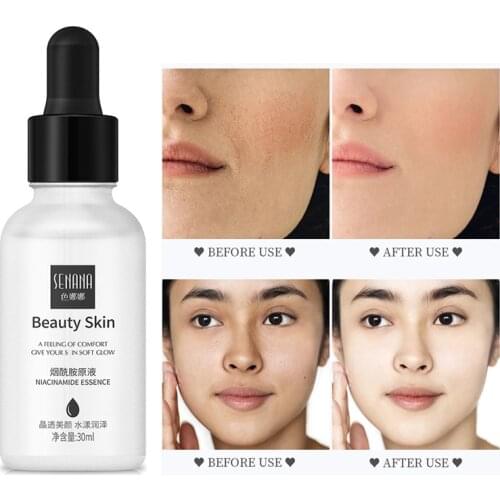 Niacinamide Whitening Facial Essence Deep Moisturizing Anti-acne Serum Repairs Skin Prevents Melanin Brighten Skin Care Liquid