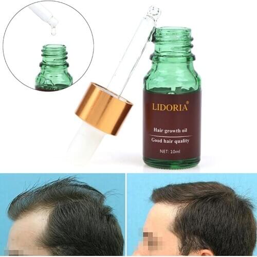 Ginger Fast Hair Growth Serum Essential Oil Anti Preventing Hair Lose Liquid Damaged Hair Repair Growing Dropship