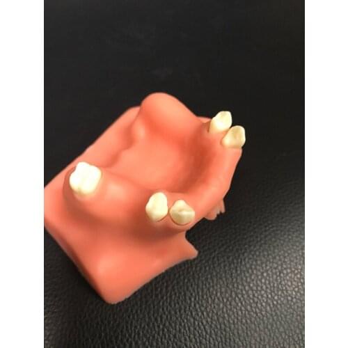 Dental Teeth Teaching Model Oral Equipment Materials Dental Consumables Maxillary Sinus Lifting Exercise Model