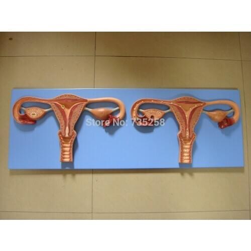 Fertilization Process Simulator,Egg Fertilization Model