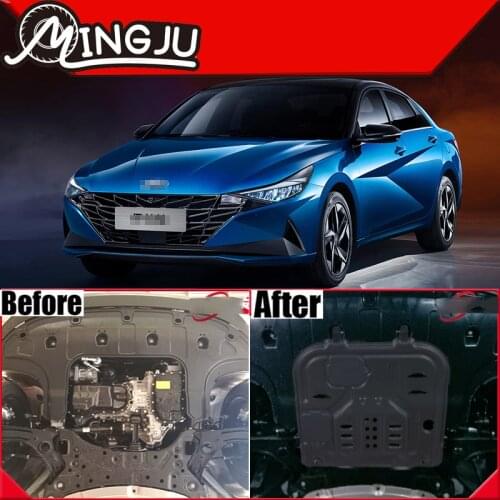 Engine Baffle Protection Plate Lower Guard Plate Engine Shield For Hyundai Elantra CN7 1.4T 1.5L 2020 2021 Accessories