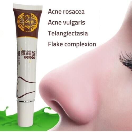 Herbal Anti Nose Mites Remove Acne Rosacea Cream Red Nose Blackhead Remover Acne Treatment Shrink Pores Face Bleaching Ointment
