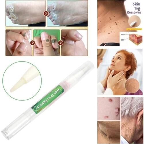 3ml Skin Tag Remover Pen Tu Kill Remover Medical Skin Tag Mole Genital Wart Remover Foot Corn Verruca Wart Remover Liquid NEW