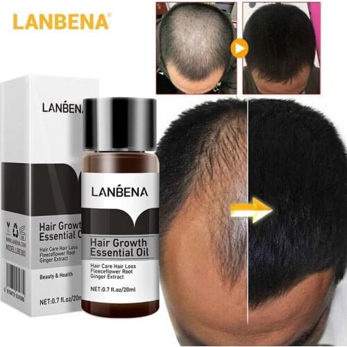 LANBENA Powerful Ginger Hair Growth Essence Effective Prevent Hair Loss Products Essential Oil Hair Care Treatment for Women Men