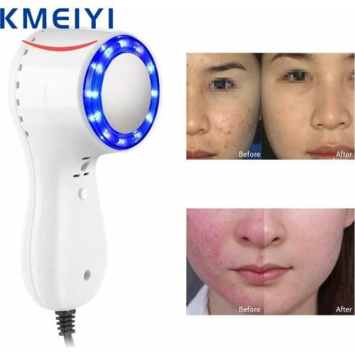 Photon Therapy Blue Light LED Facial Cold Hammer For Skin Rejuvenation Spots Spa