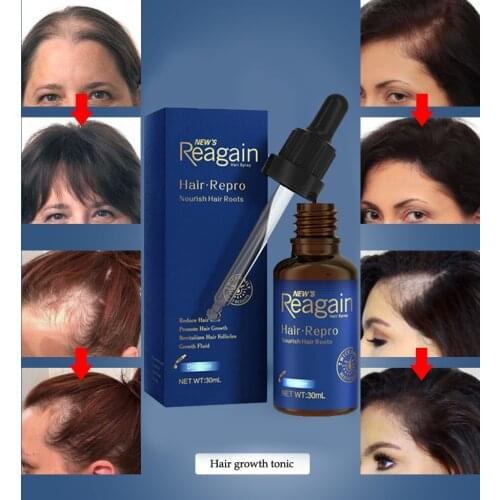 Hair Growth Essence Essential Oil Hair Growth Serum Nourishing Soften Treatment Anti Hair Loss Liquid Repair Damaged Hair Care