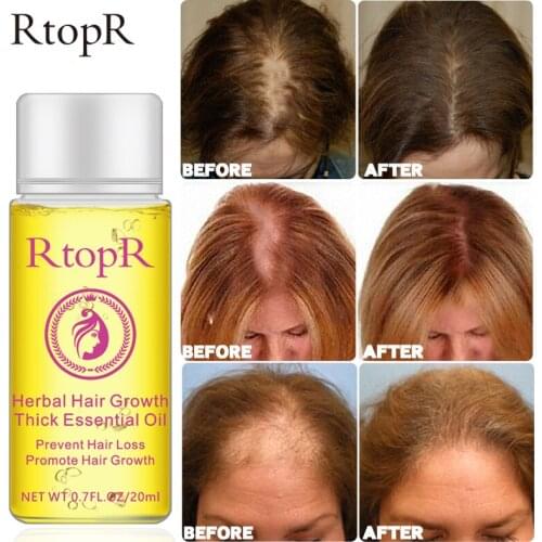 Herbal Hair Growth Thick Essential Oil Anti Hair Loss Liquid Promote Thick Fast Hair Growth Treatment Health Care Beauty Essence