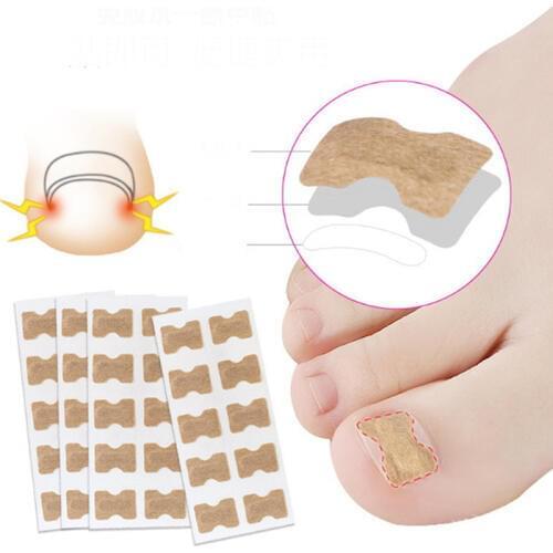 10Pcs/Set Ingrown Toenail Correction Patch Toenail Brace Pedicure Tool Double-sided Tape Nail Repair