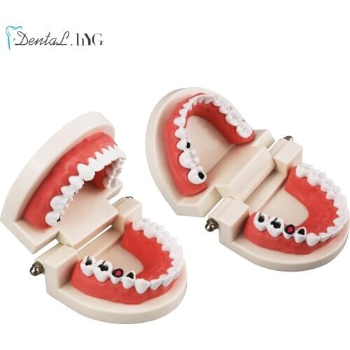 Dental Teeth Model Standard Child Teeth Disease Model Pro Oral Teeth Whitening Medical Training Studying Teaching Education Tool